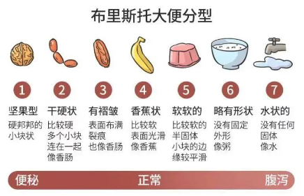如果大便形状变得细长条状,可能是因为肠管的下段变得狭窄,有异物导致