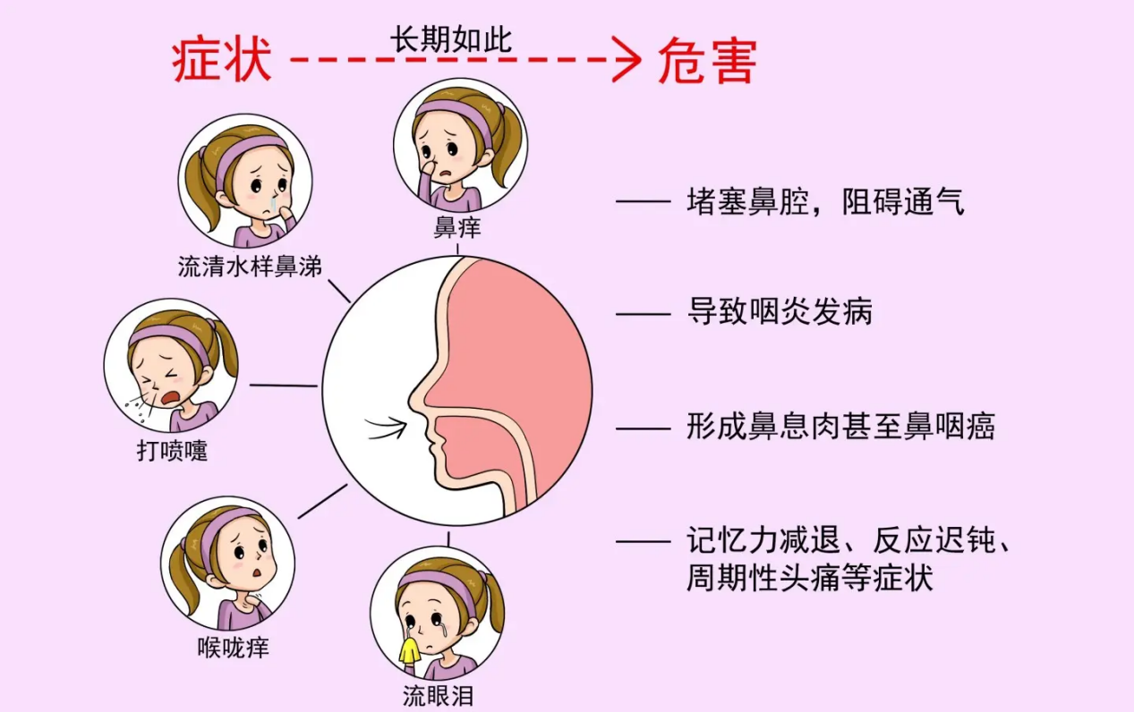 因此,发现孩子有过敏性鼻炎症状,要尽早到医院进行检查,接受科学治疗