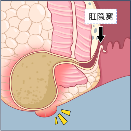 肛门周围颜色图片