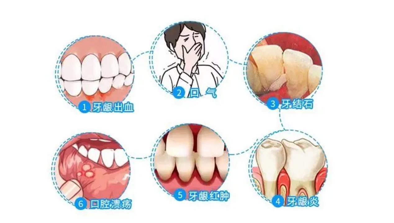 廖汉英主任：“牙周与正畸联合治疗”满足患者的需求升级