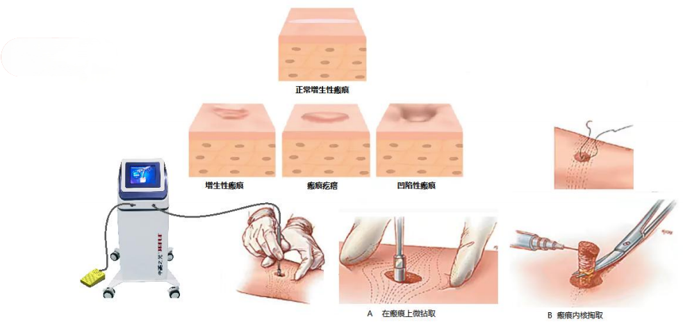 新疆威兹曼高峰：用专业守护每一份美丽期待