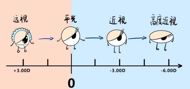 想要在巩义配眼镜？还得去明德眼科医院，视光中心专家提醒广大家长：什么情况下，孩子近视的发展会加快？ 